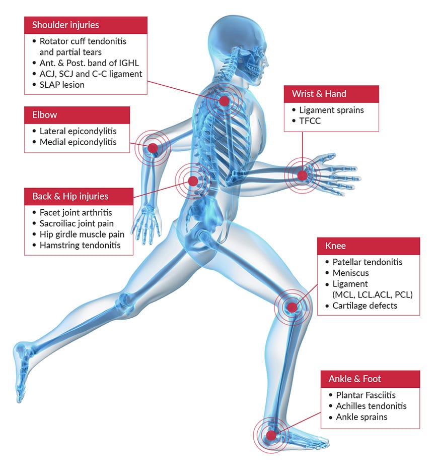 Platelet Rich Plasma Therapy Differ from Other Options